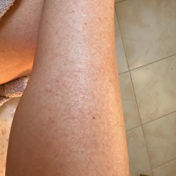 Sebamed Sun Care Koruyucu Güneş Spreyi Ve After Sun Ürün Şikayeti