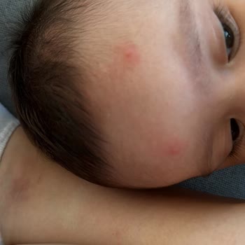 Nurse Harvey’s Bebekler İçin Riskli Ürün