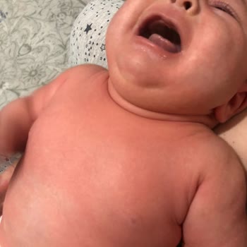 Sma 1 Comfort Ciddi Kızarıklık Alerji