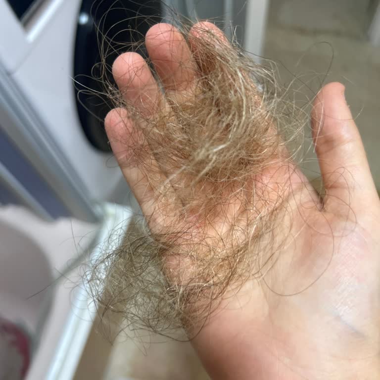 Kayseri San Kuaför Saçımı Yaktı