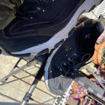 Skechers Yanları Yırtılan Ayakkabım