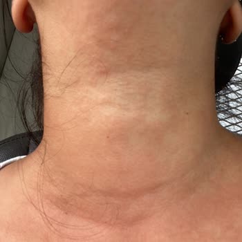 Sinoz Ürünler Yüzünden Canımdan Oluyordum