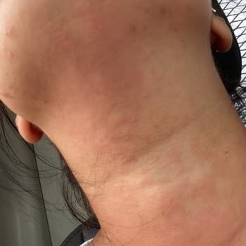 Sinoz Ürünler Yüzünden Canımdan Oluyordum