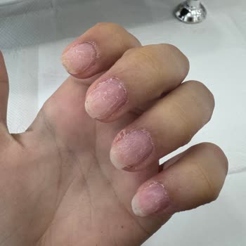 Aymira Koçaklı Yaşam Merkezi Silivri Şubesi'nde Yaşadığım Tırnak Hizmeti Sorunu