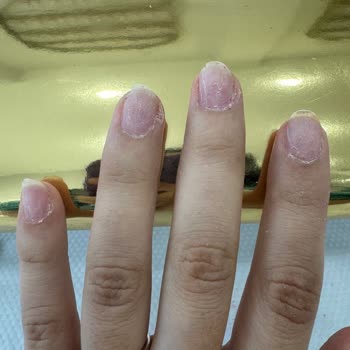 Aymira Koçaklı Yaşam Merkezi Silivri Şubesi'nde Yaşadığım Tırnak Hizmeti Sorunu