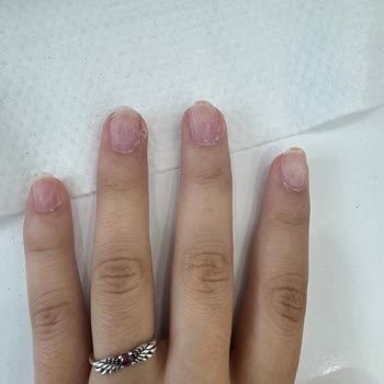 Aymira Koçaklı Yaşam Merkezi Silivri Şubesi'nde Yaşadığım Tırnak Hizmeti Sorunu