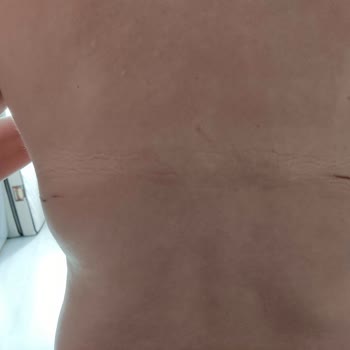 Suwen Kurum Mağduriyeti Yaşadım