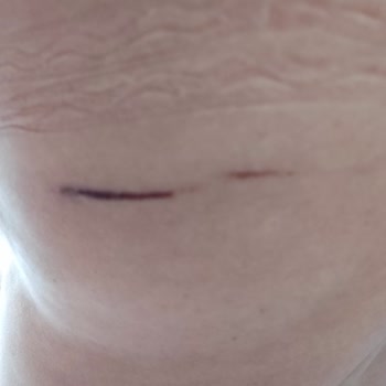 Suwen Kurum Mağduriyeti Yaşadım