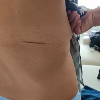 Suwen Kurum Mağduriyeti Yaşadım