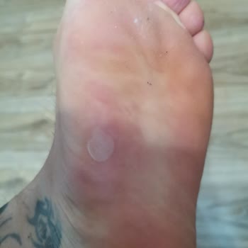 Adidas кроссовки порвались за 2,5 месяца и нет гарантии