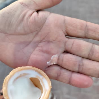 Ete Cafe İnsan Canı Bu Kadar Değersiz Olmamalı