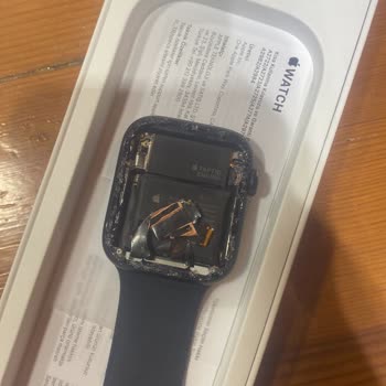 Teknosa Apple Watch Kasko Problemi