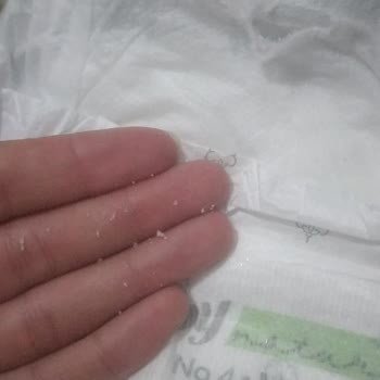 A101 Bezde Yabancı Madde Yara Yaptı