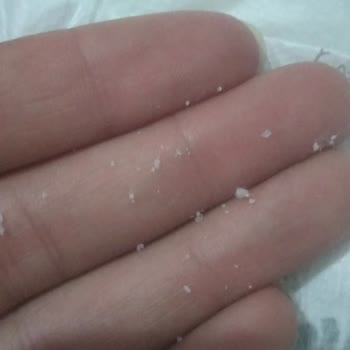 A101 Bezde Yabancı Madde Yara Yaptı