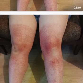 Escabel Kozmetik İntense Tanning Oil Carrot Bronzlaştırıcı Yağ