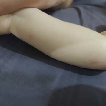 Mustela Spf50 Güneş Kremi Sivilce Yaptı!