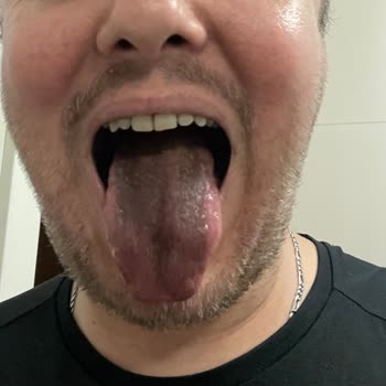 A101 Den Aldığımız Üründen Dolayı Ölümden Döndük