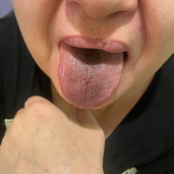 A101 Den Aldığımız Üründen Dolayı Ölümden Döndük