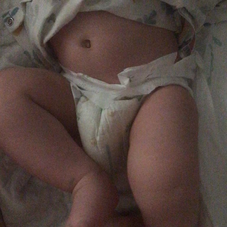 Baby Turco Bebek Bezi Cırt Cırtları Tutmuyor