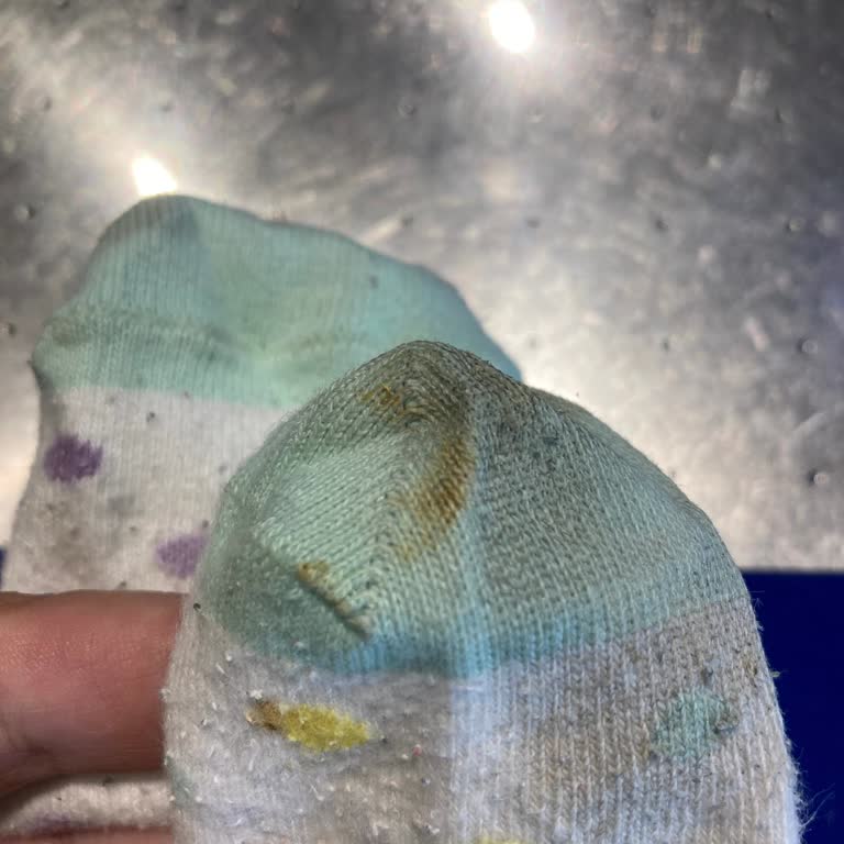 Maltepe Park Playland Oyun Alanında Dışkı Ve Bulunamayan Çözüm