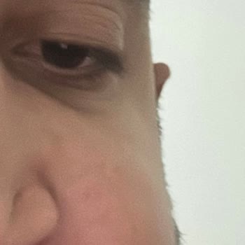 Ankara Onkoloji Acil Polikliniği 23.06.2024.