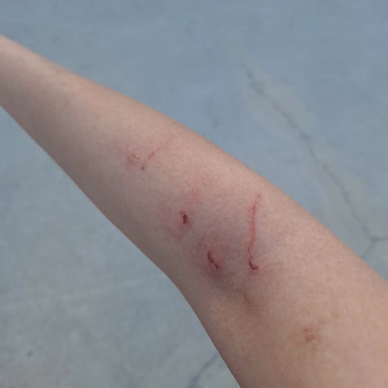 Eda Bayazıt Epilasyon Güzellik Mağdur Etti