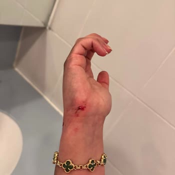 Ajet 6 Saat Rötar Ve Arızalı Seyyar Merdiven Korkunçluğu