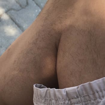 Enza Güzellik Merkezleri Epilasyon Hizmetinde Yaşanan Sorunlar Ve Memnuniyetsizlik