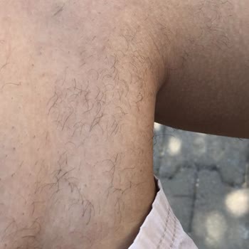 Enza Güzellik Merkezleri Epilasyon Hizmetinde Yaşanan Sorunlar Ve Memnuniyetsizlik