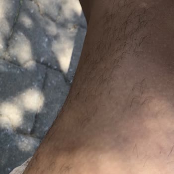 Enza Güzellik Merkezleri Epilasyon Hizmetinde Yaşanan Sorunlar Ve Memnuniyetsizlik