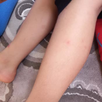 Tarsus Belediyesi A*** Ç** Tarsus Belediyesine