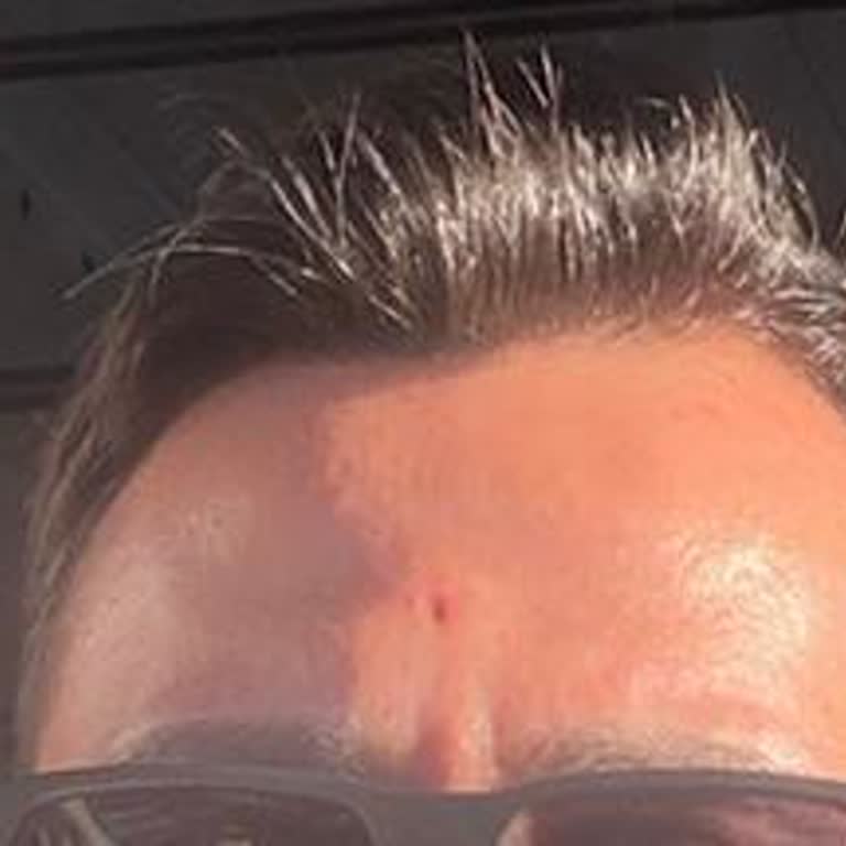 Inday Klinik Başarısız Tedavi