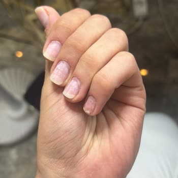 Serpil Bolatcan Beauty Center Kalitesiz İşlem