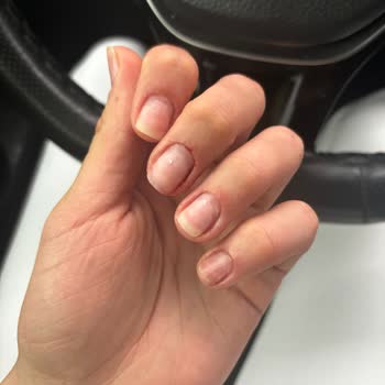 Serpil Bolatcan Beauty Center Kalitesiz İşlem