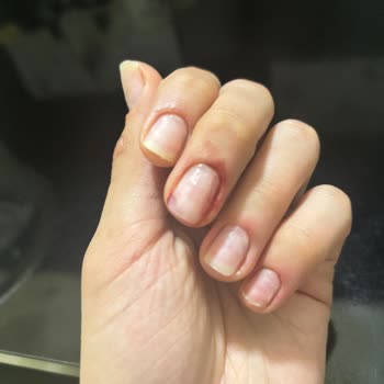 Serpil Bolatcan Beauty Center Kalitesiz İşlem