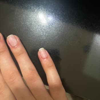 Serpil Bolatcan Beauty Center Kalitesiz İşlem