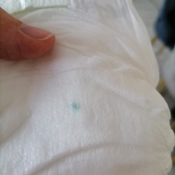 Sleepy Bebeklerimizin Sağlığı Her Şeyden Önce Gelir