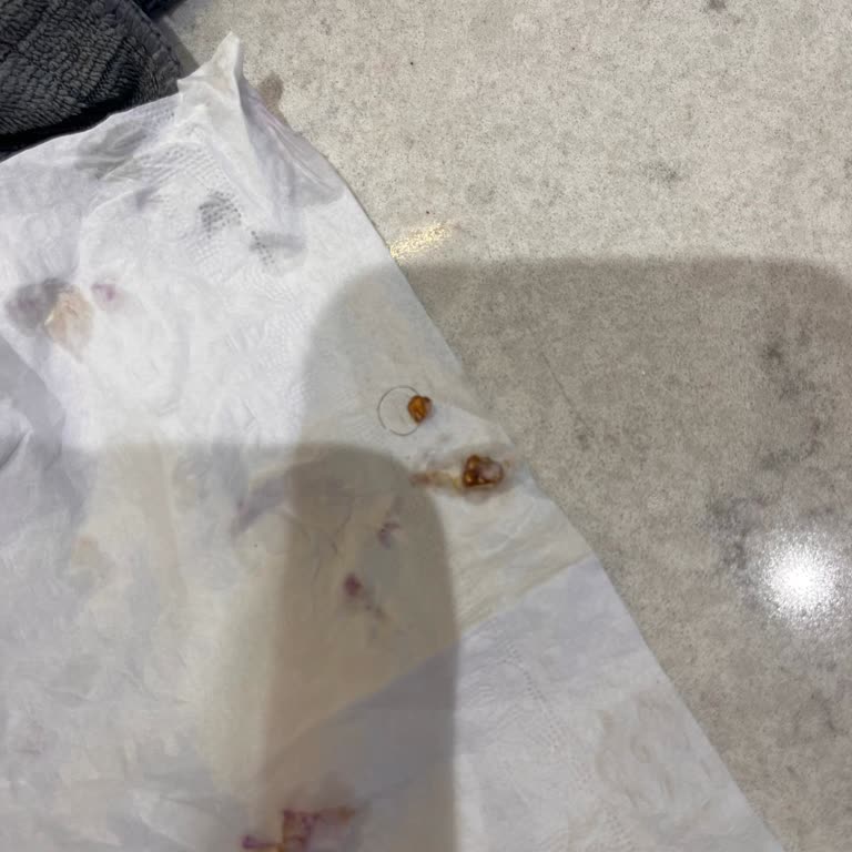 Glutensiz Fabrika GRONALA'DAN Kıl Çıktı