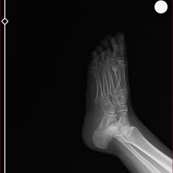 Korkuteli Belediyesi Park Çıkışındaki Açık Drenaj Kanalı Sorunu