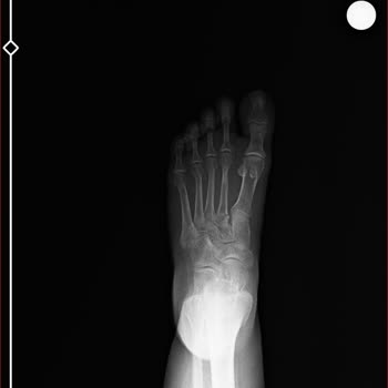 Korkuteli Belediyesi Park Çıkışındaki Açık Drenaj Kanalı Sorunu