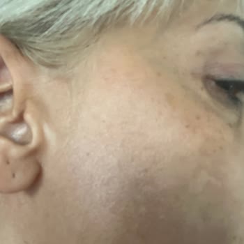 Yves Rocher Her Yerde Reklam Yapan Leke Karstı Krem Leke Yapıyor