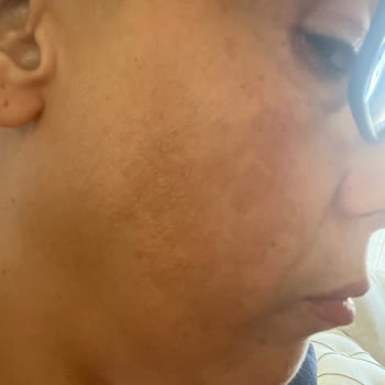 Yves Rocher Her Yerde Reklam Yapan Leke Karstı Krem Leke Yapıyor