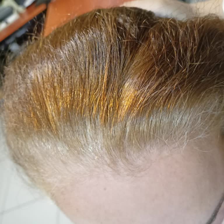 Loreal Paris Saç Boyası Hayal Kırıklığı: Renk Tutmadı!