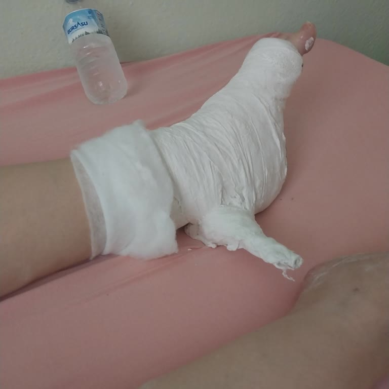 Sağlık Bakanlığı Acil Serviste Yapılan Hatalı Protez Uygulaması