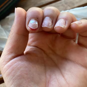 Asmina Güzellik Tırnağımı Çıkarırken Etimle Birlikte Koparttılar