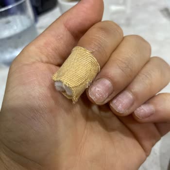 Asmina Güzellik Tırnağımı Çıkarırken Etimle Birlikte Koparttılar