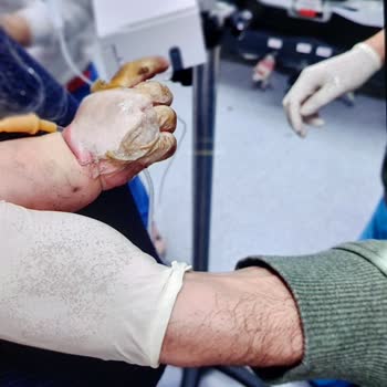 Sağlık Bakanlığı El Cerrahisi Uzmanı Bulamıyoruz