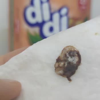 Didi Nın İçinden Çok Kötü Bir Şey Çıktı