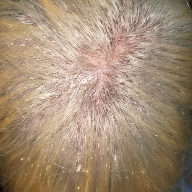 Kuaför Yurda (Malatya) Yurda Kuaför Malatya