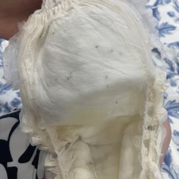 Acil İlgilenilmeli Sleepy Külot Bez Yabancı Maddeler